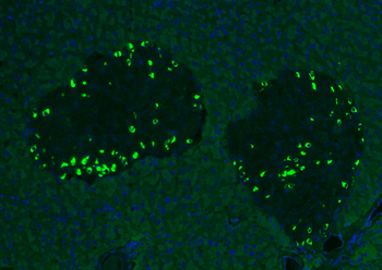 GLP1 antibody