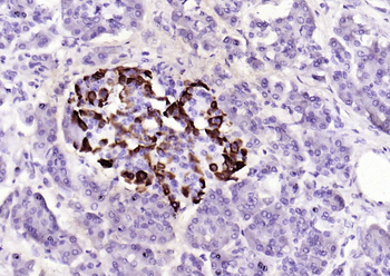 GLP1 antibody