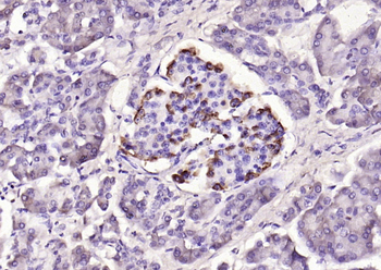 GLP1 antibody