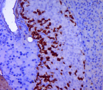 GLP1 antibody