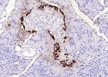 GLP1 antibody