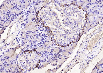 GLP1 antibody