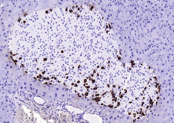 GLP1 antibody