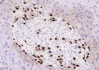 GLP1 antibody