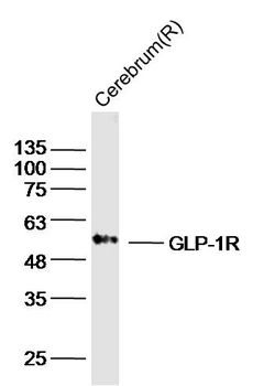 GLP1 Receptor antibody