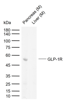 GLP1 Receptor antibody