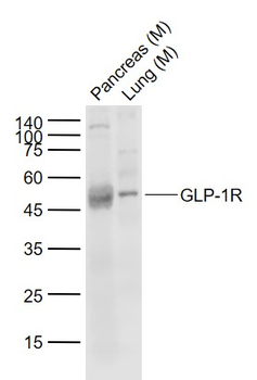 GLP1 Receptor antibody