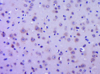 GPR30 antibody