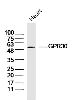 GPR30 antibody