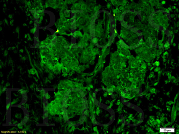 GPR30 antibody