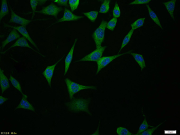 GPR30 antibody