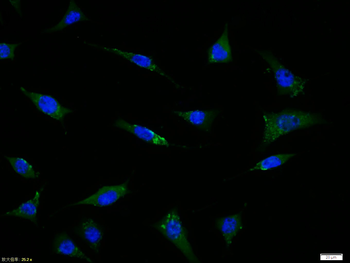 GPR30 antibody