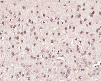 GRP75 antibody