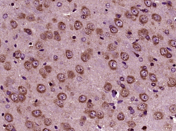 GRP94 antibody