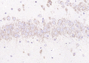 GRP94 antibody