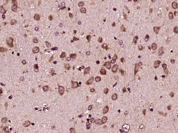 GRP94 antibody