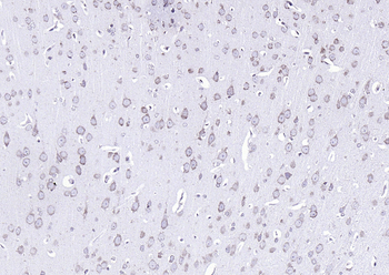 GRP94 antibody