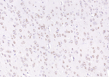 GRP94 antibody