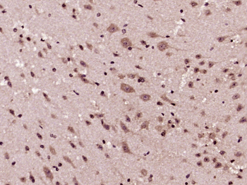 GSK3 Beta antibody