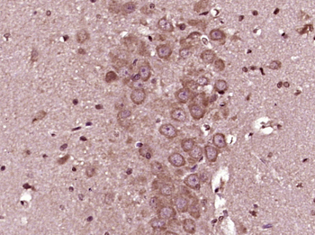 GSK3 Beta antibody