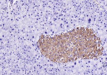 GSK3 Beta antibody