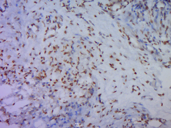 GSK3 beta (phospho-Ser9) antibody