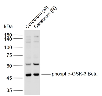 GSK3 beta (phospho-Ser9) antibody