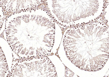 HSTF2/HSF2 antibody