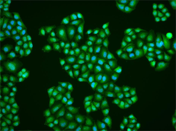 HSTF2/HSF2 antibody