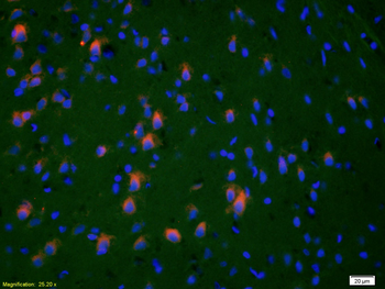 HSP27 antibody