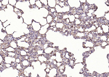 HSP47 antibody