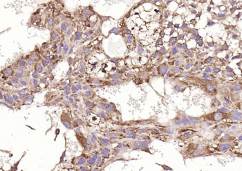 HSP47 antibody