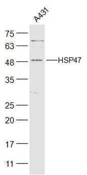 HSP47 antibody