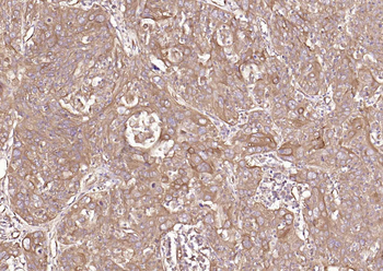 HSP47 antibody