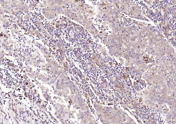 HSP47 antibody