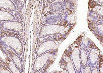 HSP47 antibody