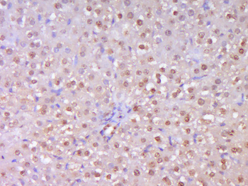 TRT antibody