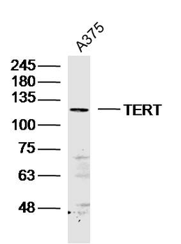 TRT antibody