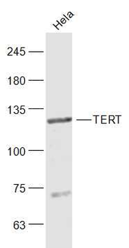 TRT antibody