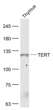 TRT antibody