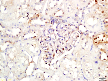 NFKB Inhibitor alpha antibody