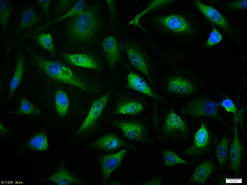 NFKB Inhibitor alpha antibody