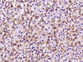 gp130 antibody