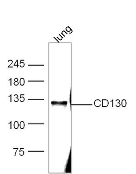 gp130 antibody