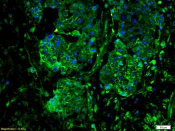 gp130 antibody