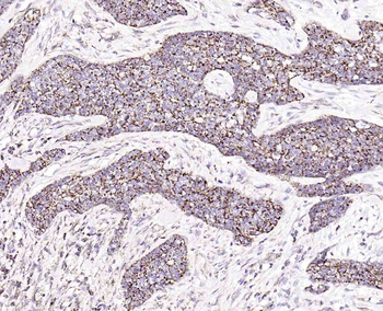 IL-8/CXCL8 Rabbit Polyclonal Antibody