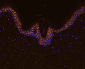 IL8 antibody