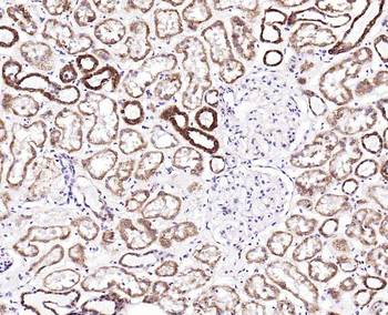 IL8 antibody