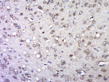 Integrin beta 1 antibody