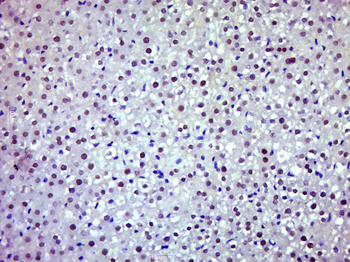 JAK2 antibody